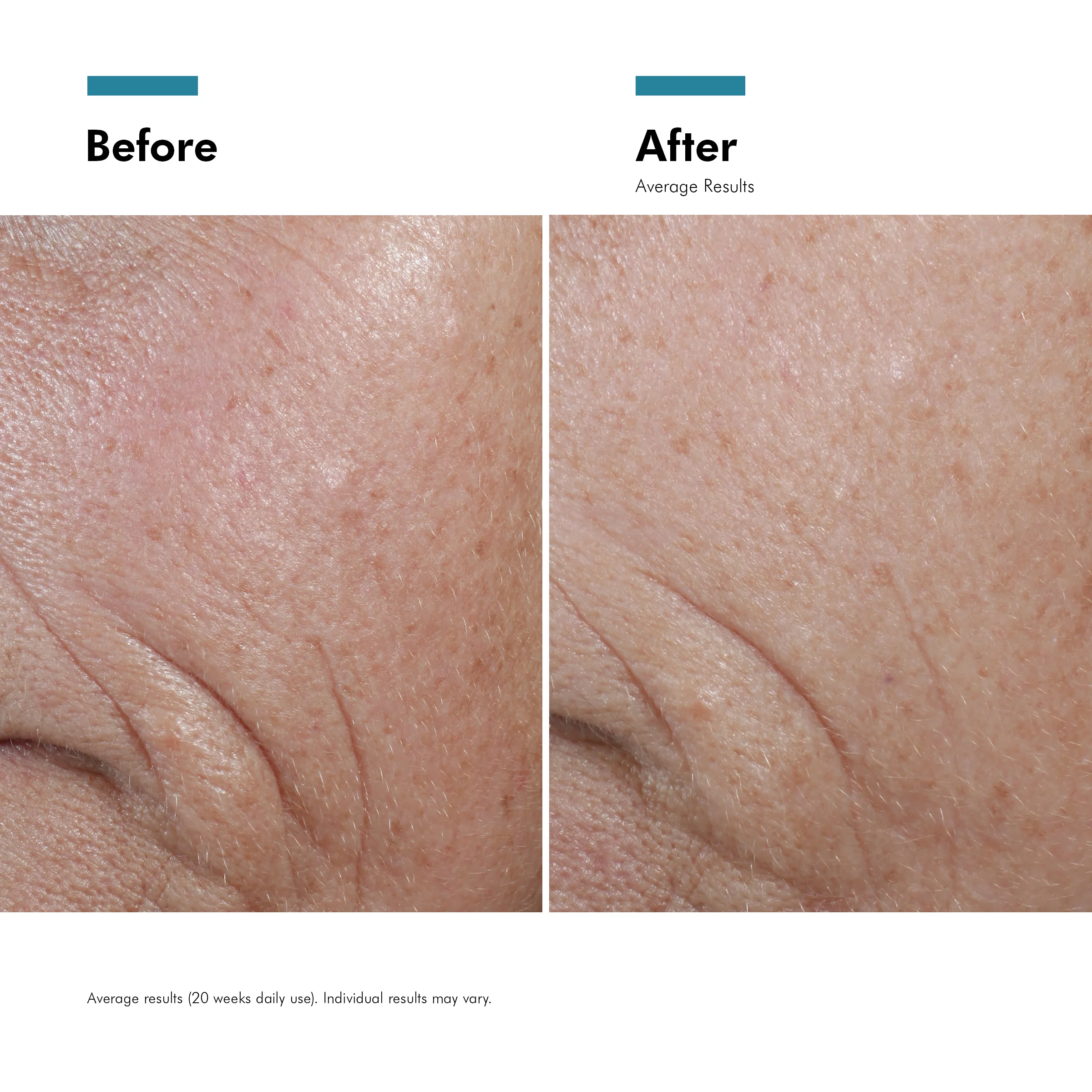 SkinCeuticals C E Ferulic 30ml - Image 20