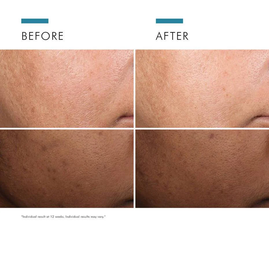 SkinCeuticals Discoloration Defense Serum 30ml - Image 7