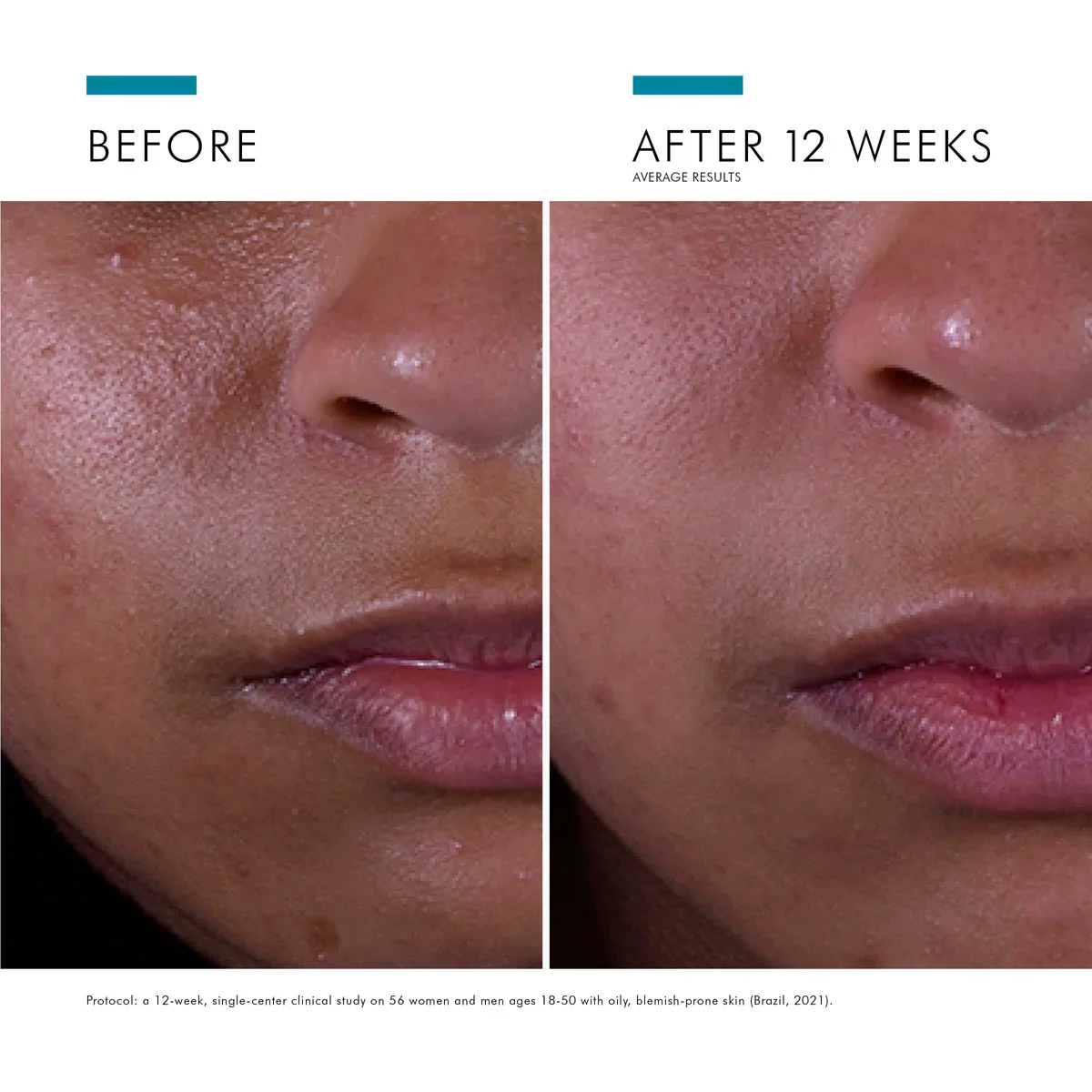 SkinCeuticals Silymarin CF 30ml STAR DEAL - Image 7