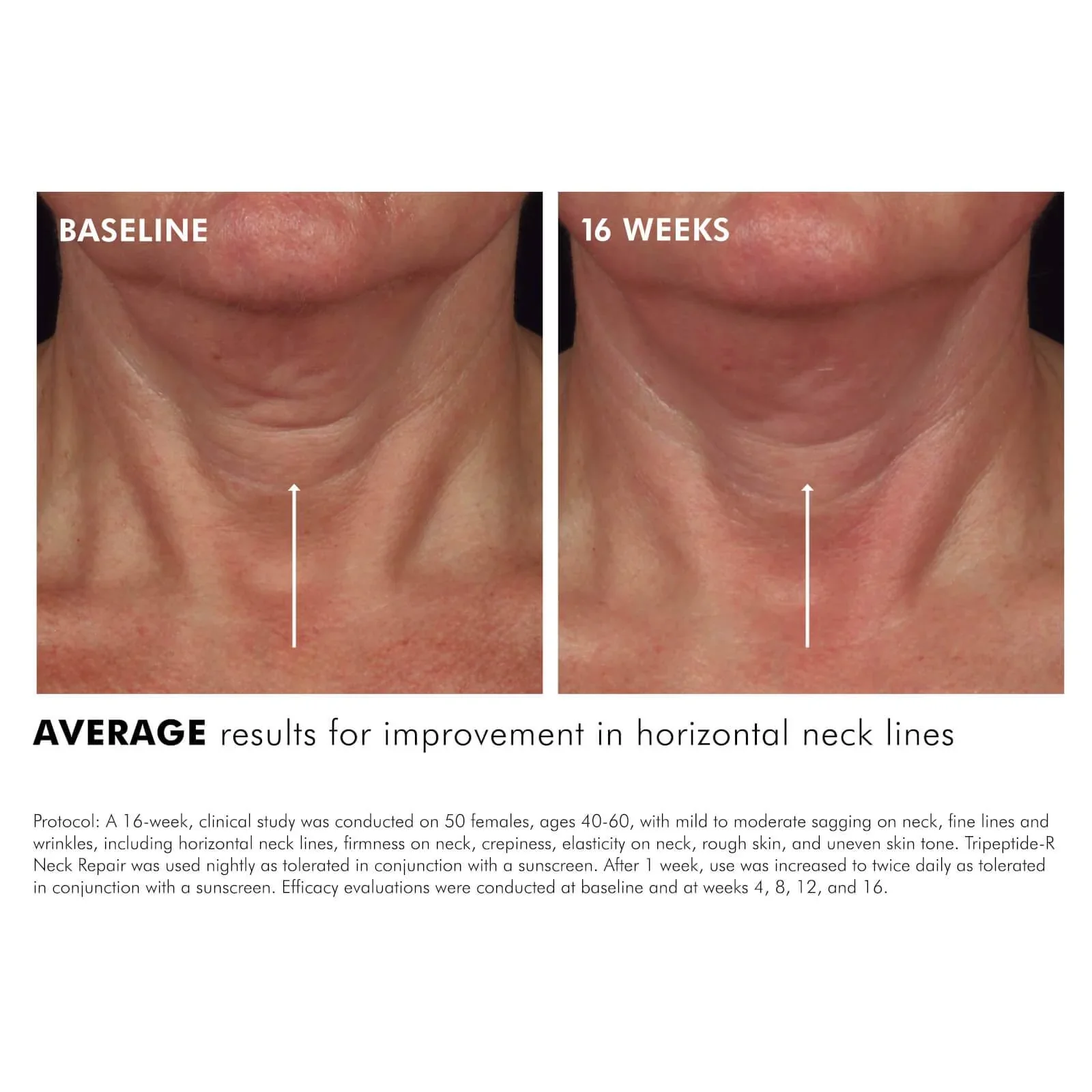 SkinCeuticals Tripeptide-R Neck Repair 50ml - Image 6